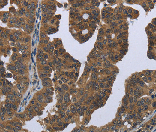 Anti-Human/Mouse/Rat GYS2 Antibody - ABMIUM