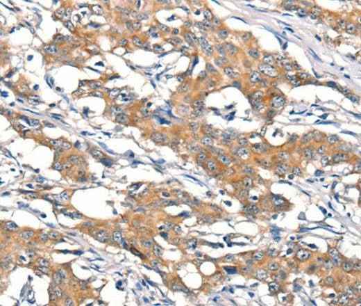 Anti-Human/Mouse DSC1 Antibody