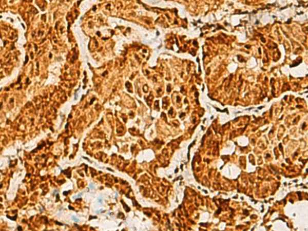 Anti-Human/Mouse SAP30BP Antibody