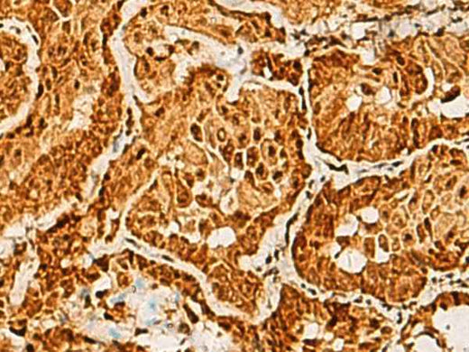 Anti-Human/Mouse SAP30BP Antibody