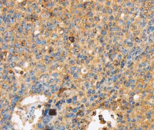 Anti-Human/Mouse/Rat ERK 3 Antibody