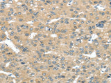 Anti-Human/Mouse TUSC2 Antibody - ABMIUM