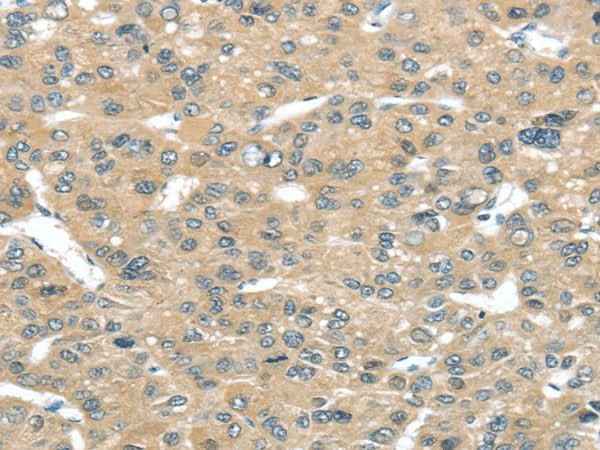 Anti-Human/Mouse TUSC2 Antibody