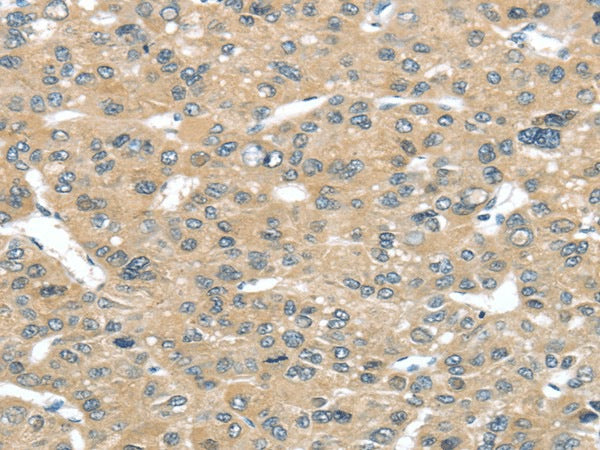 Anti-Human/Mouse TUSC2 Antibody - ABMIUM
