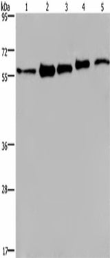 Anti-Human/Mouse HNRNP L Antibody - ABMIUM