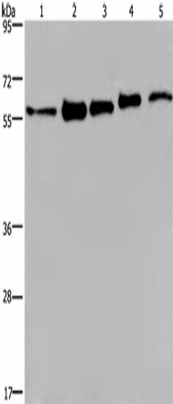 Anti-Human/Mouse HNRNP L Antibody - ABMIUM