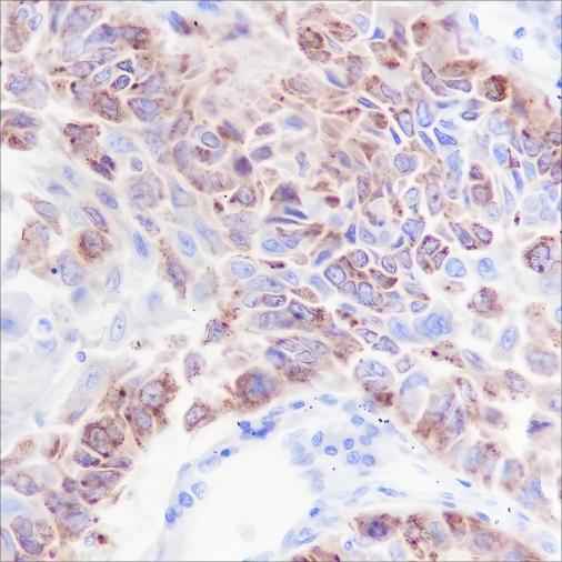 Anti-Human/Mouse iNOS Antibody [A267] - ABMIUM
