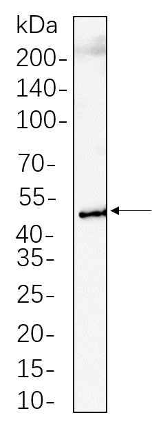 Anti-Mouse RIP3 Antibody [B1121] - ABMIUM