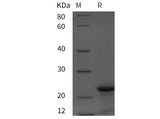 SDS-PAGE analysis of Rat Calcitonin/CT proteins, 2 μg/lane of Recombinant Rat Calcitonin/CT proteins was resolved with SDS-PAGE under reducing conditions, showing bands at 22 kDa.