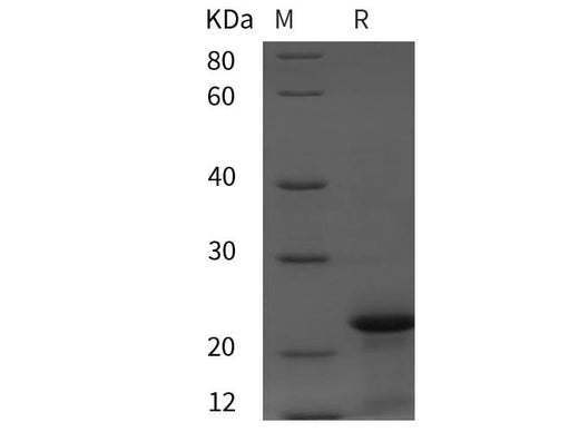SDS-PAGE analysis of Rat Calcitonin/CT proteins, 2 μg/lane of Recombinant Rat Calcitonin/CT proteins was resolved with SDS-PAGE under reducing conditions, showing bands at 22 kDa.