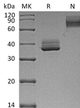 Recombinant Mouse TNFRSF17/BCMA Protein (Fc Tag) - ABMIUM
