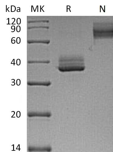 Recombinant Mouse TNFRSF17/BCMA Protein (Fc Tag) - ABMIUM