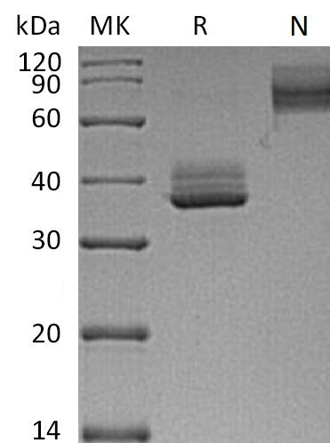 Recombinant Mouse TNFRSF17/BCMA Protein (Fc Tag) - ABMIUM