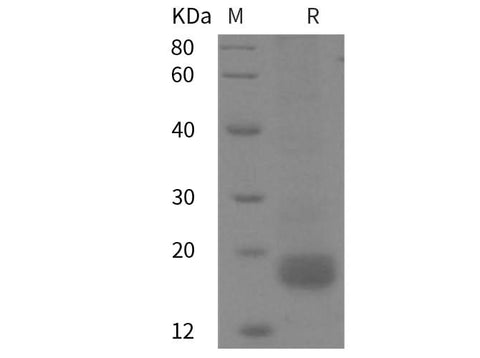 SDS-PAGE analysis of Rat IFN-γ/IFNG proteins, 2 μg/lane of Recombinant Rat IFN-γ/IFNG proteins was resolved with SDS-PAGE under reducing conditions, showing bands at 18 kDa.