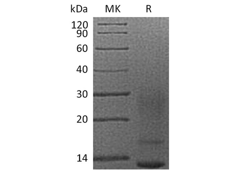 Recombinant Human Interleukin-13/IL-13 Protein (His Tag) - ABMIUM