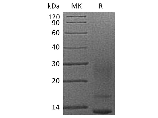 Recombinant Human Interleukin-13/IL-13 Protein (His Tag) - ABMIUM