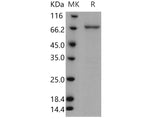 > 91 % as determined by reducing SDS-PAGE.