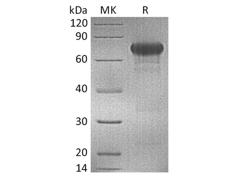 Recombinant Human OX40/TNFRSF4 Protein (mFc Tag) - ABMIUM