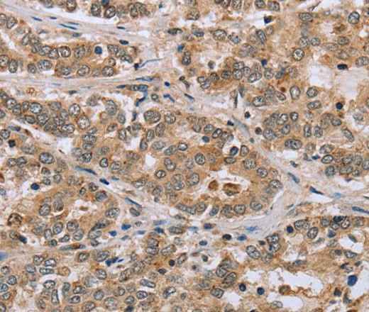 Anti-Human CLEC16A Antibody