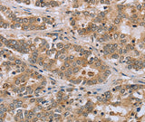 Anti-Human CLEC16A Antibody - ABMIUM