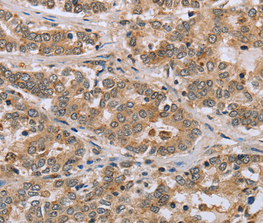 Anti-Human CLEC16A Antibody - ABMIUM