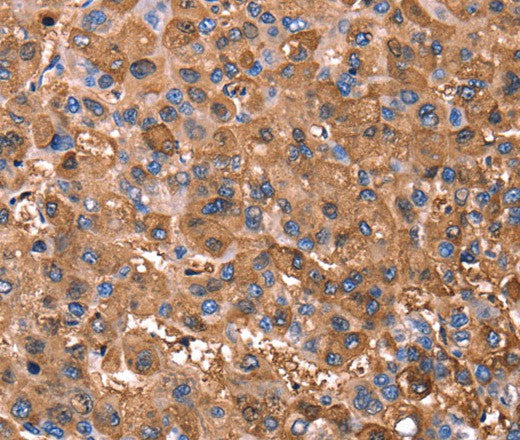 Anti-Human ERN2 Antibody - ABMIUM