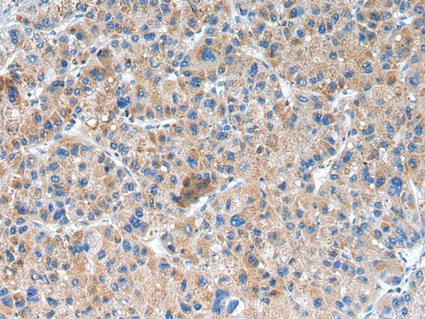 Anti-Human/Mouse/Rat GLRA1 Antibody - ABMIUM