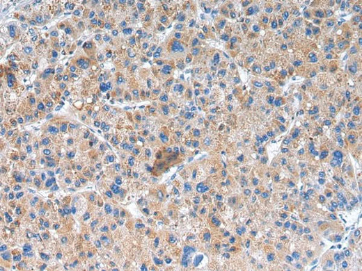 Anti-Human/Mouse/Rat GLRA1 Antibody - ABMIUM