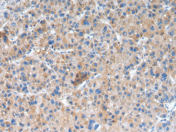 Anti-Human/Mouse/Rat GLRA1 Antibody - ABMIUM
