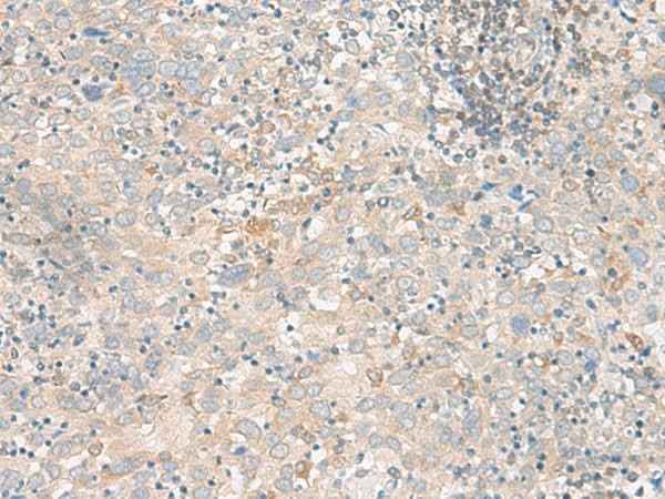 Anti-Human/Mouse/Rat FGF13 Antibody