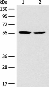 Western blot analysis of Mouse brain tissue NIH/3T3 cell lysates using CORO2B Polyclonal Antibody at dilution of 1:1000