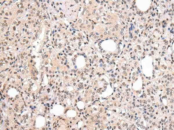 Anti-Human/Mouse/Rat CBX7 Antibody