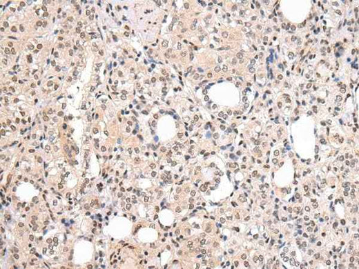 Anti-Human/Mouse/Rat CBX7 Antibody
