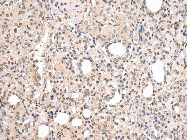 Anti-Human/Mouse/Rat CBX7 Antibody - ABMIUM