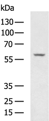 Anti-Human PLAT Antibody - ABMIUM
