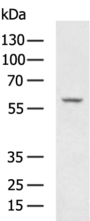Anti-Human PLAT Antibody - ABMIUM