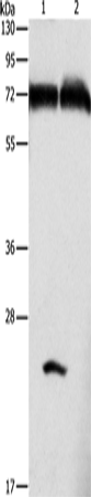 Anti-Human/Mouse GDPD5 Antibody - ABMIUM