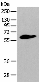 Western blot analysis of Human prostate tissue using STEAP2 Polyclonal Antibody at dilution of 1:400