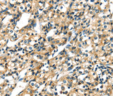 Anti-Human/Mouse/Rat CK-17 Antibody - ABMIUM
