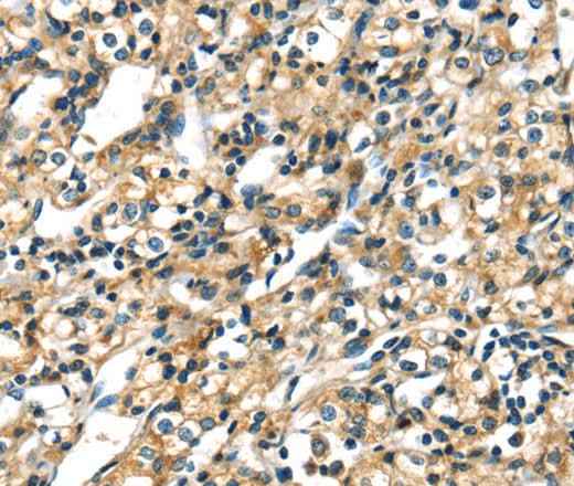 Anti-Human/Mouse/Rat CK-17 Antibody