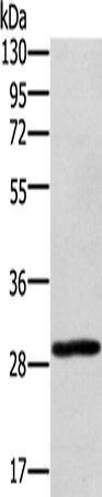 Anti-Human EDA2R Antibody - ABMIUM