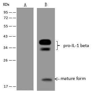 Anti-Human IL1B Antibody [A860] - ABMIUM