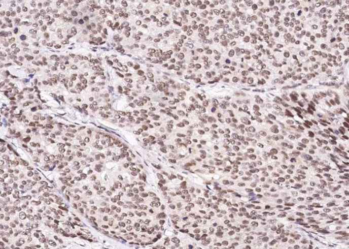 Anti-Human CUEDC2 Antibody [B151] - ABMIUM