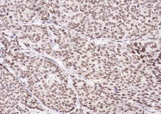 Anti-Human CUEDC2 Antibody [B151] - ABMIUM