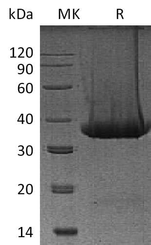 Recombinant Mouse Kallikrein 1/KLK1 Protein (His Tag) - ABMIUM