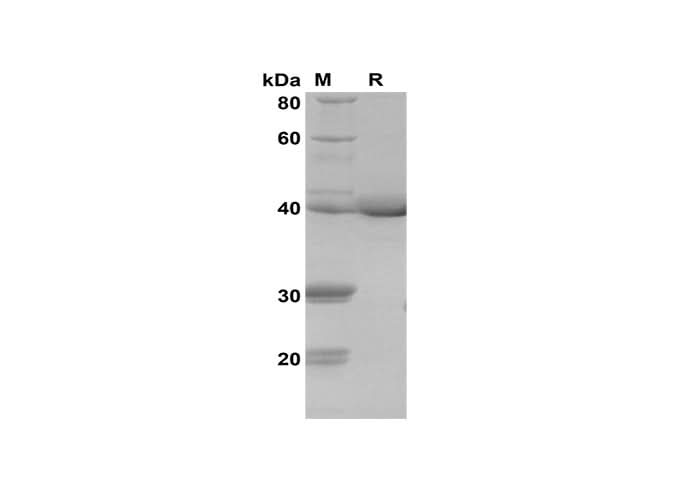 SDS-PAGE analysis of Human STAT3 APRF proteins, 2 μg/lane of Recombinant Human STAT3 APRF proteins was resolved with SDS-PAGE under reducing conditions, showing bands at 41 kDa.