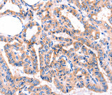 Anti-Human/Mouse/Rat ADRBK1 Antibody - ABMIUM