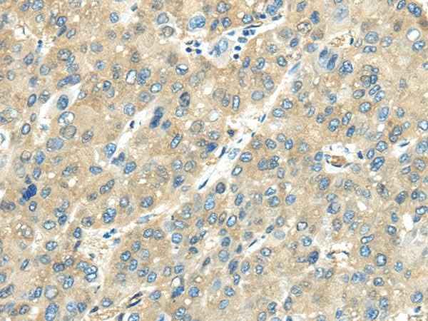 Anti-Human/Mouse/Rat VPS4A Antibody