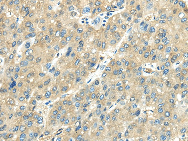 Anti-Human/Mouse/Rat VPS4A Antibody - ABMIUM