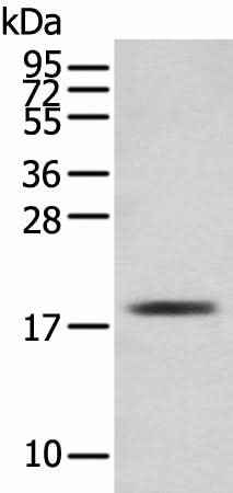 Anti-Human/Mouse TNNC1 Antibody